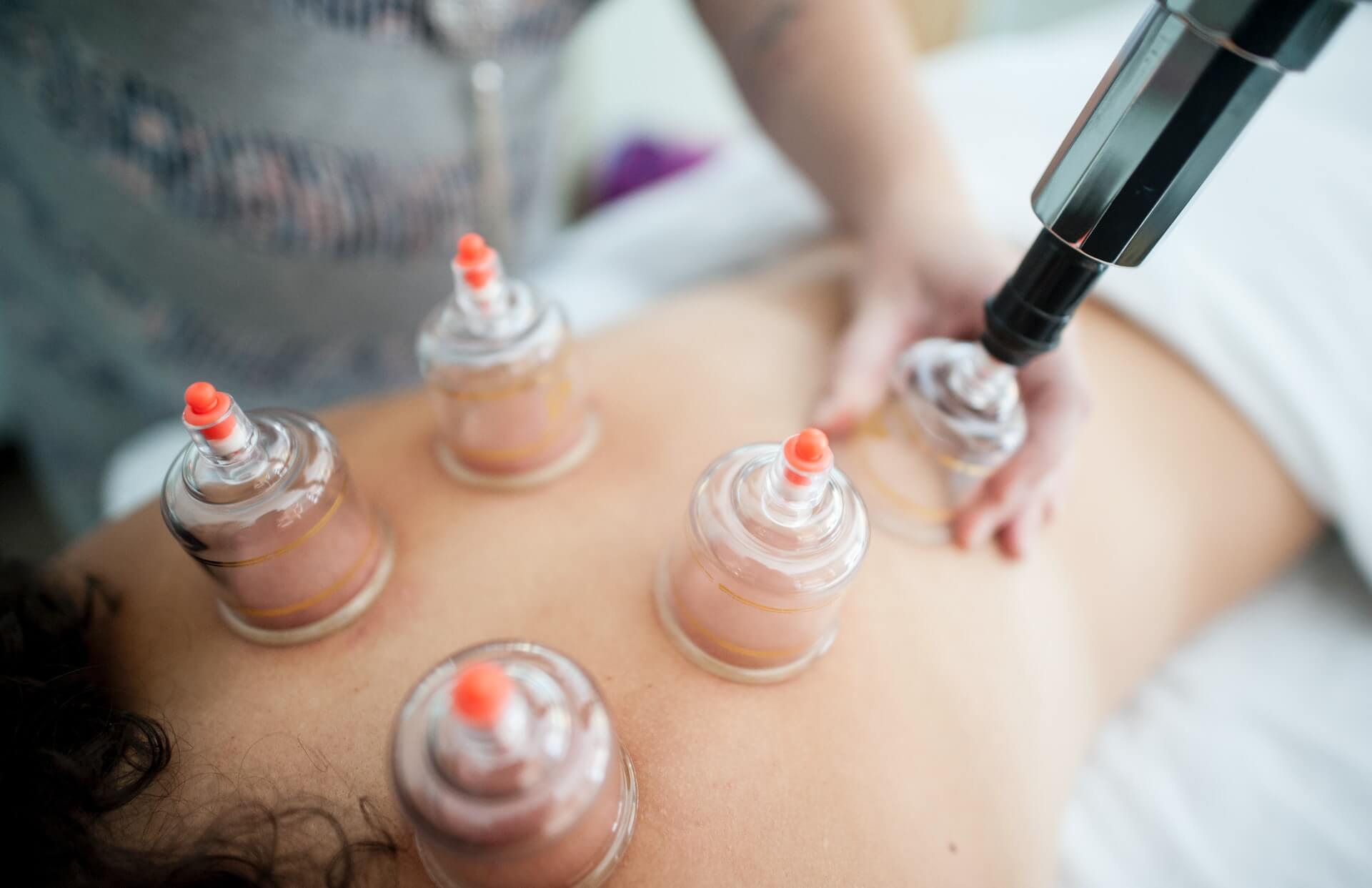 Schröpfmassage